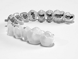 Dijital Ortodonti 